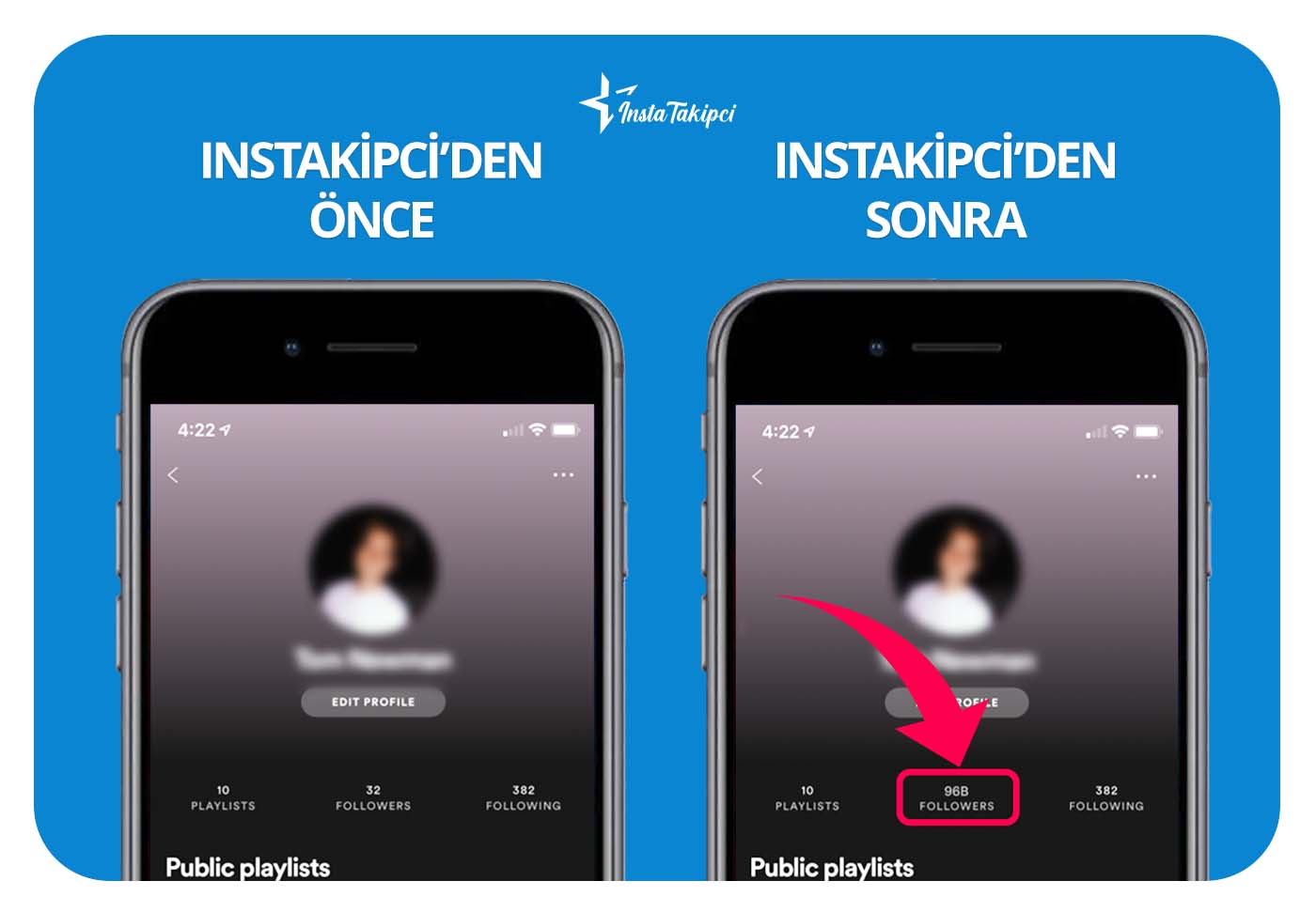 Spotify takipçi önce & sonra